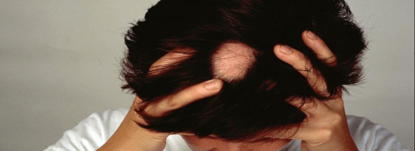 Alopecia Areata Treatment in Dubai, Abu Dhabi & Sharjah