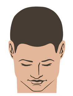 Hair transplant in Dubai