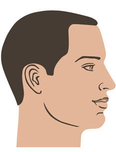 hair transplant in dubai