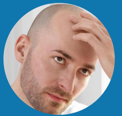 hair transplant in dubai