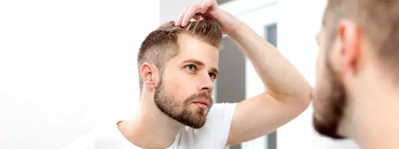 Male hair transplant in Dubai
