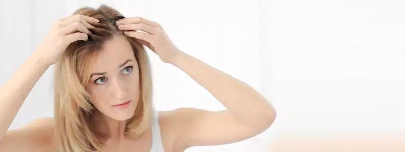 Female-hair-transplant
