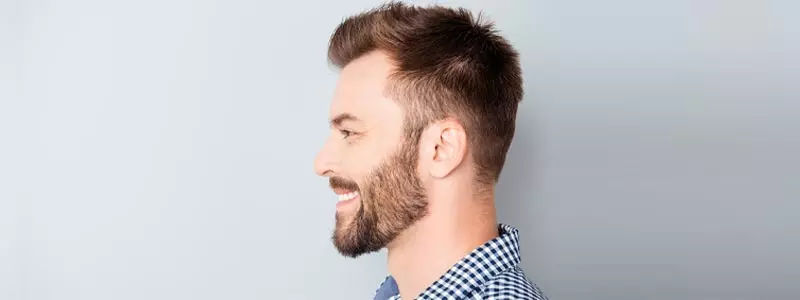 FUE-HAIR-transplant