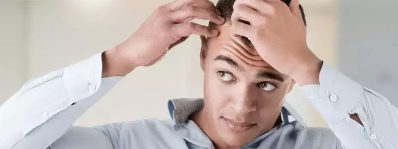 Sideburn-hair-transplant