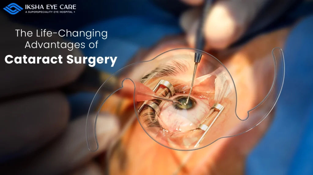 Cataract Surgery