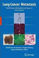 Lung Cancer Metastasis: Novel Biological Mechanisms and Impact on Clinical Practice