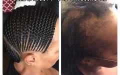 Braided Hairstyles Cover Bald Edges