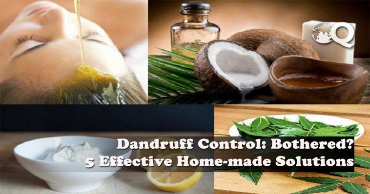 Dandruff Control