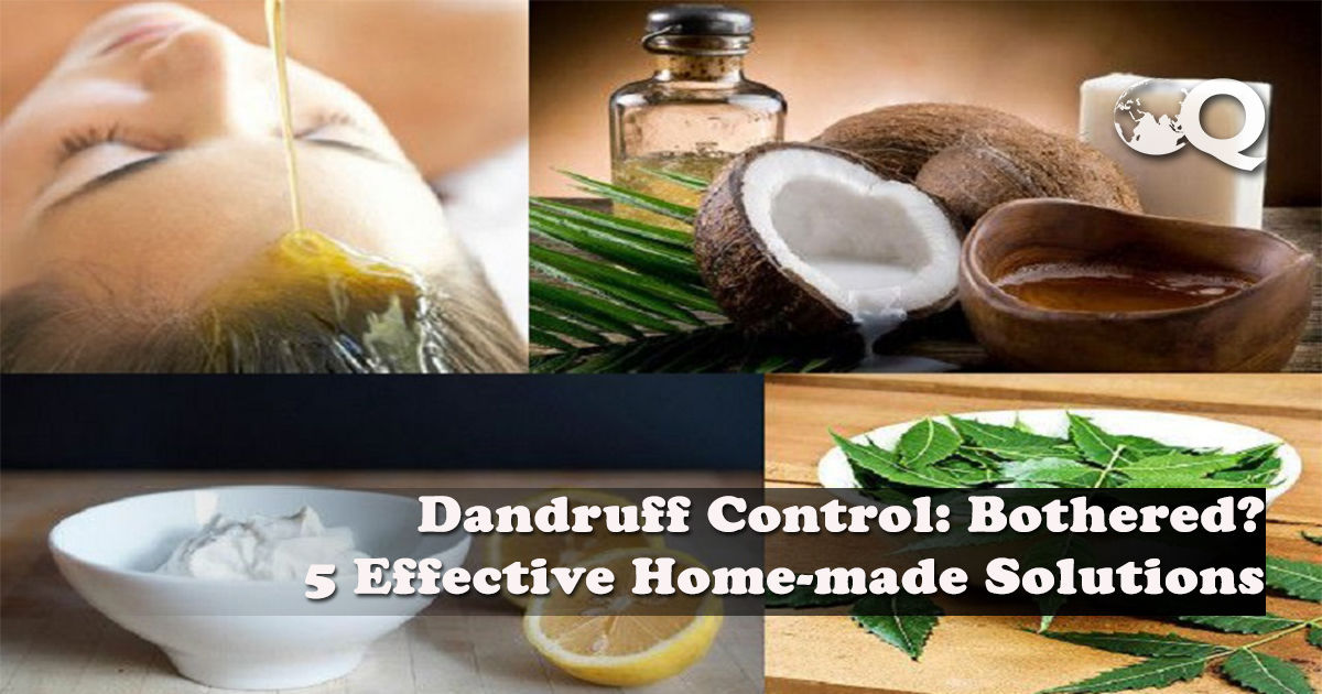 Dandruff Control