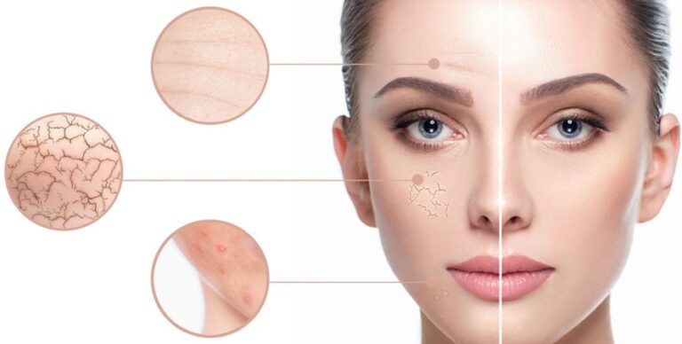 Understanding Sensitive Skin