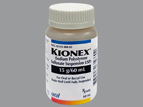 What does Kionex look like?