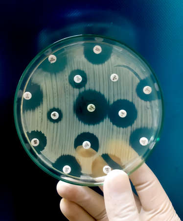 Antimicrobial susceptibility testing in petri dish