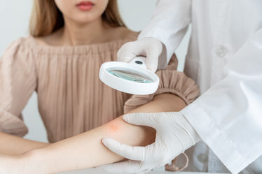 A doctor using a magnifying glass and checking a patients skin