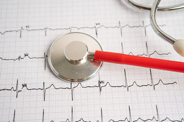 Stethoscope on electrocardiogram ECG