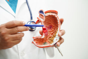 A doctor holding a model of the stomach