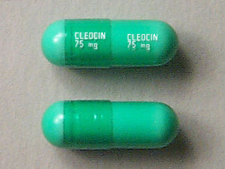 This is a Capsule imprinted with CLEOCIN  75 mg on the front, CLEOCIN  75 mg on the back.
