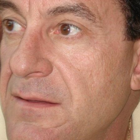 Allen Lazzer profile picture