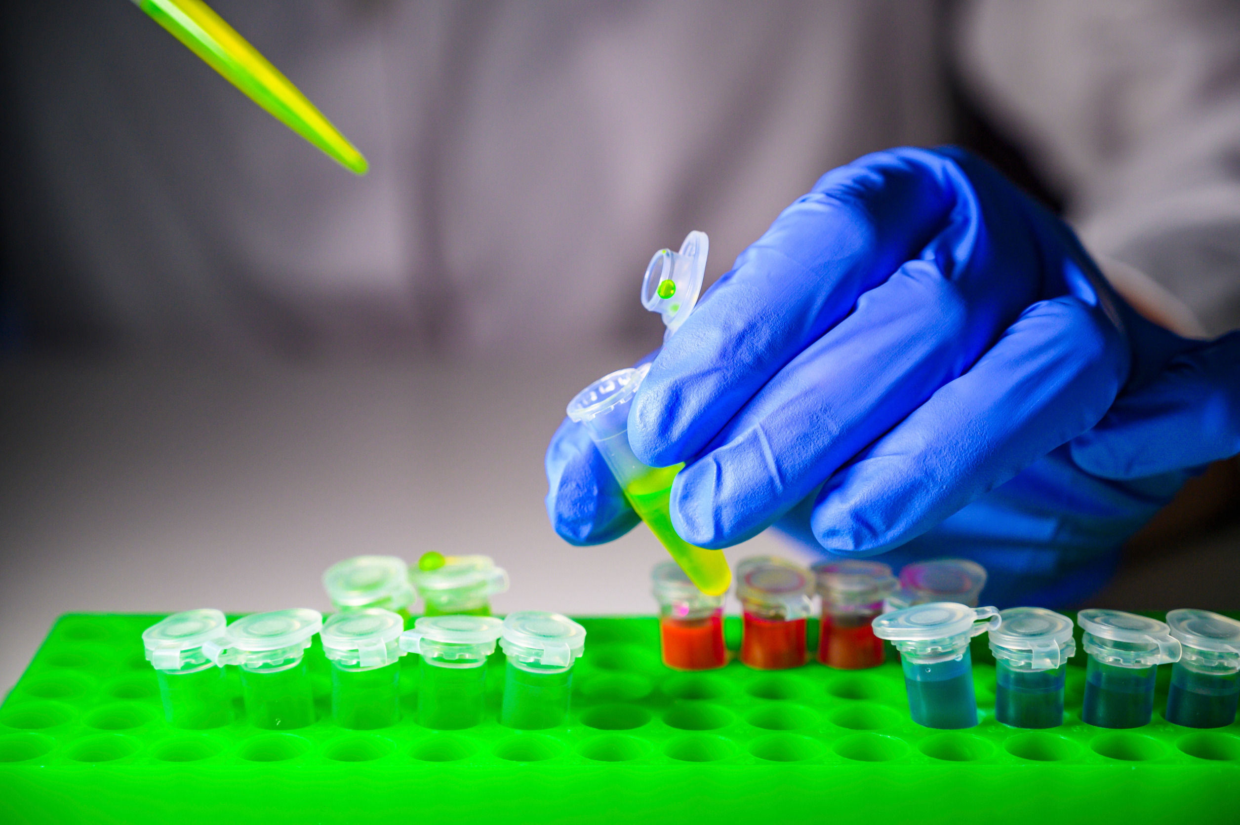 argenx stock down 25% on efgartigimod trial