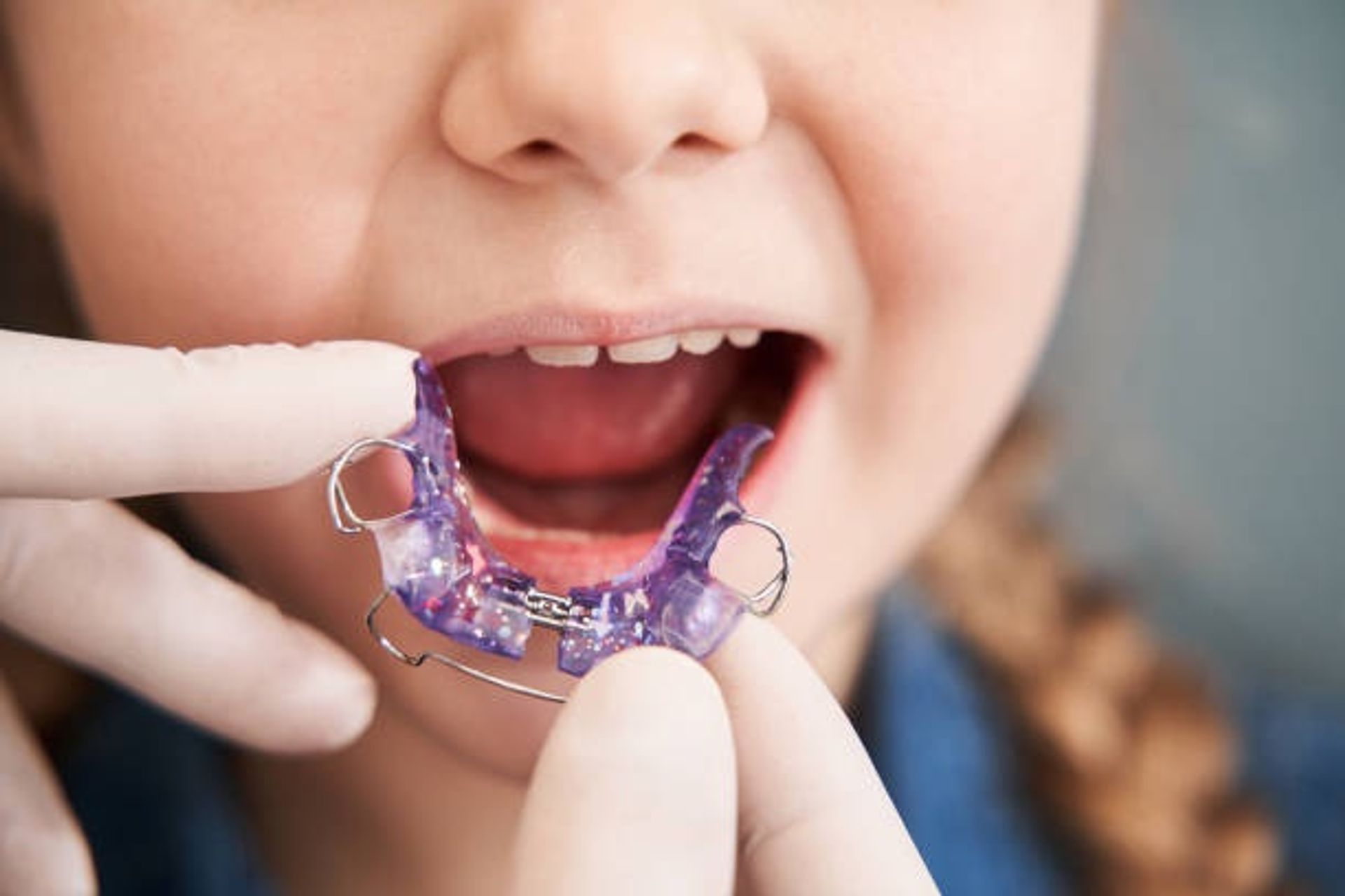 card-dental-plates