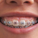 Full width smile coloured braces menu bar