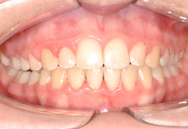 Michaela frontal final