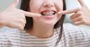 guide-braces-faq