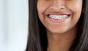 treatment-braces