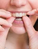 treatment-retainers