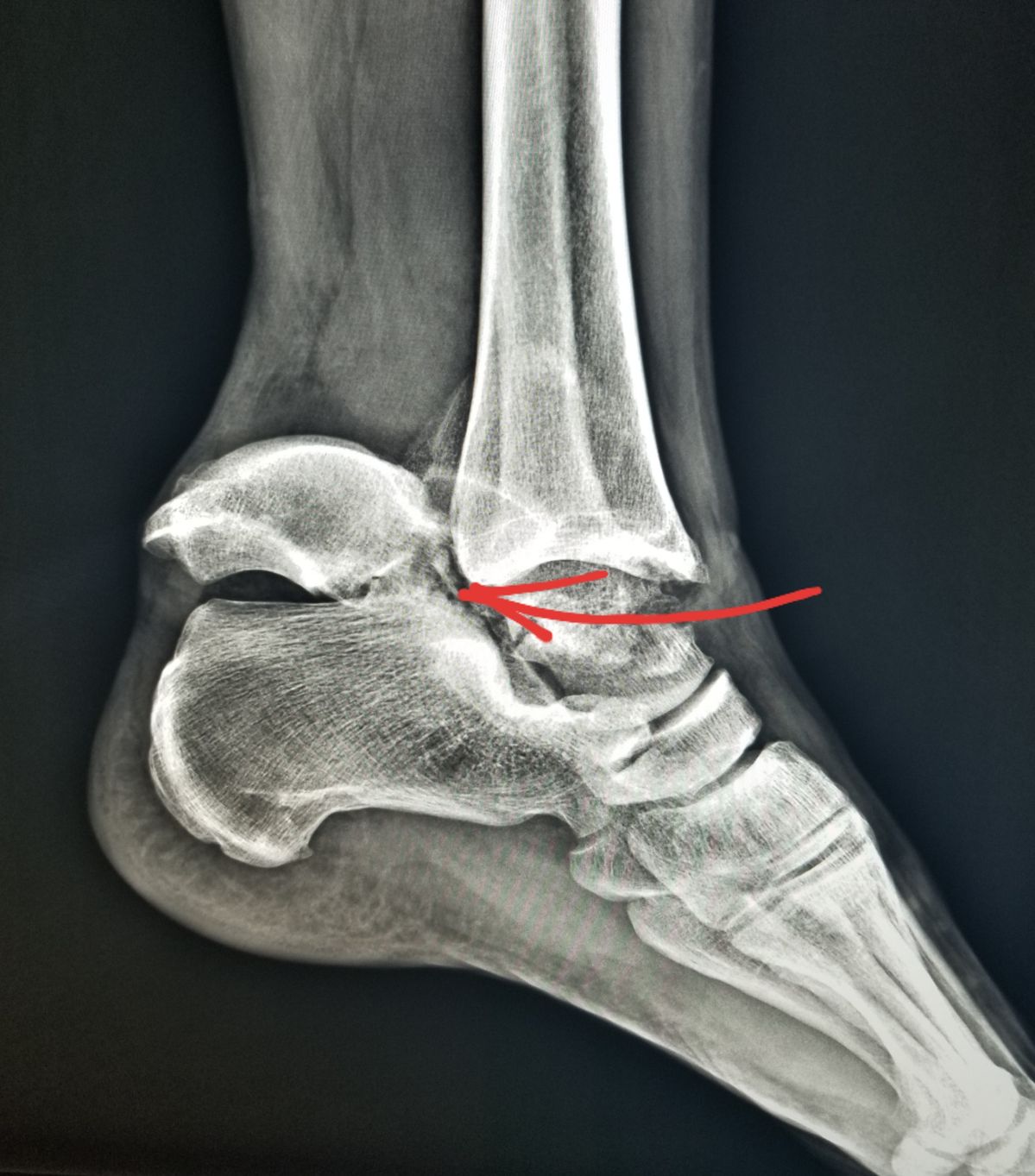 Fracture & Accident Treatment