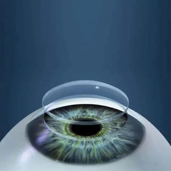 Corneal Transplant Surgery