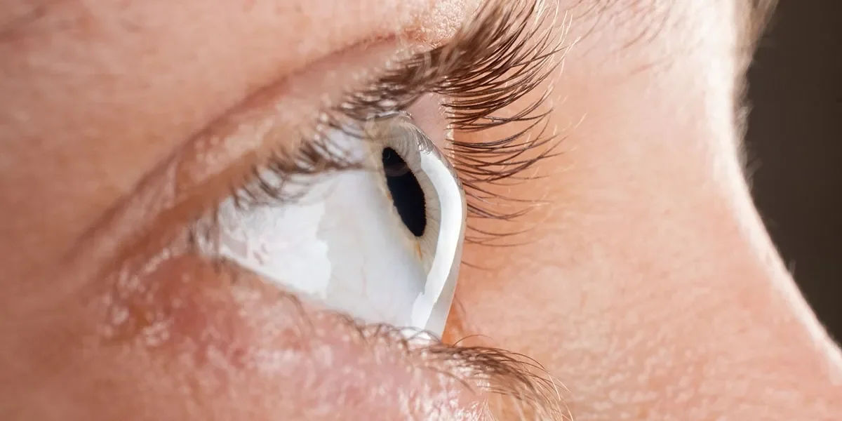 Corneal Transplant Surgery in Mumbai – Restoring Vision with Keratoplasty