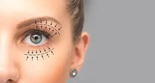 Oculoplastic Surgery & Botox