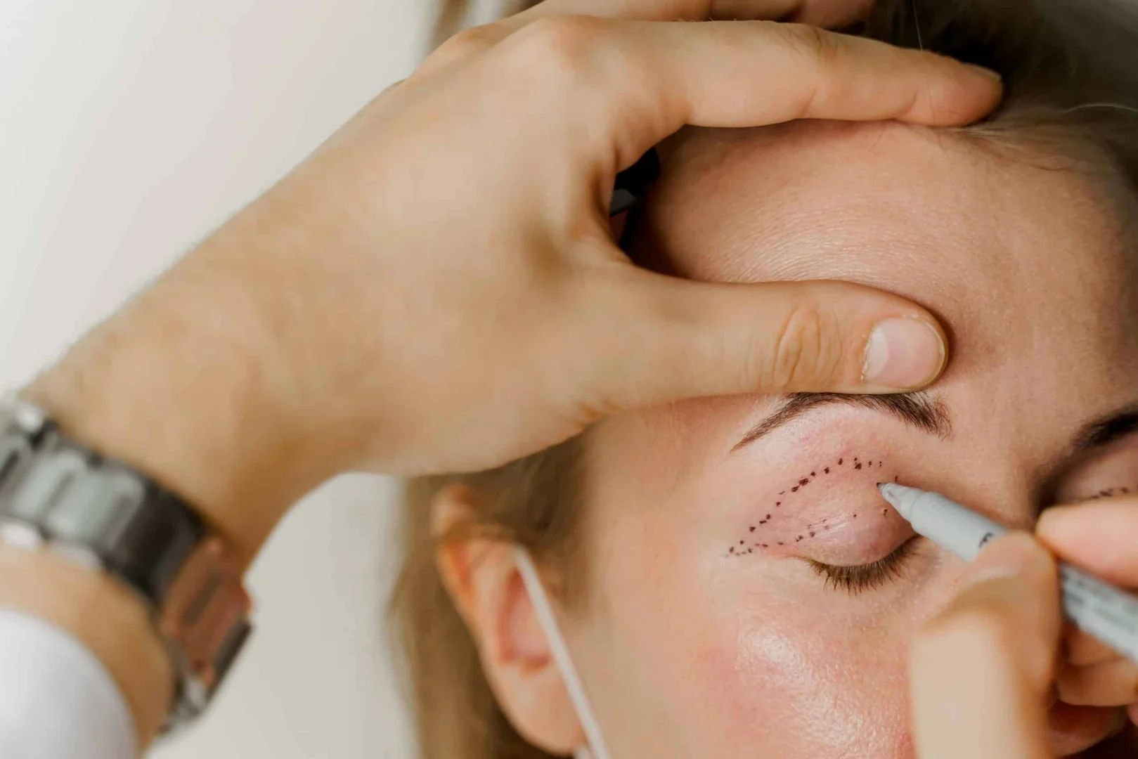 Skin Type Ocular Aesthetics in Mumbai