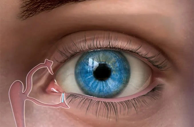 Dry Eye Treatment in Mumbai – Relief for Irritated, Tired Eyes