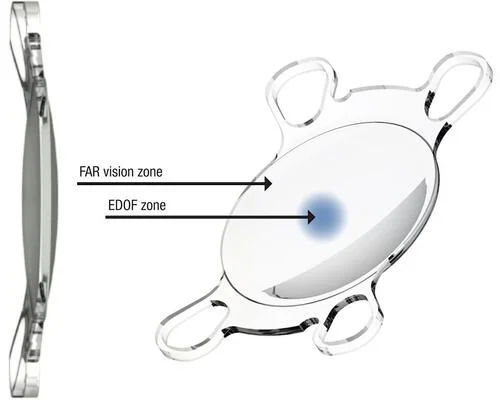 Extended Depth of Focus (EDOF) IOL Surgery in Mumbai – Natural Vision After Cataract