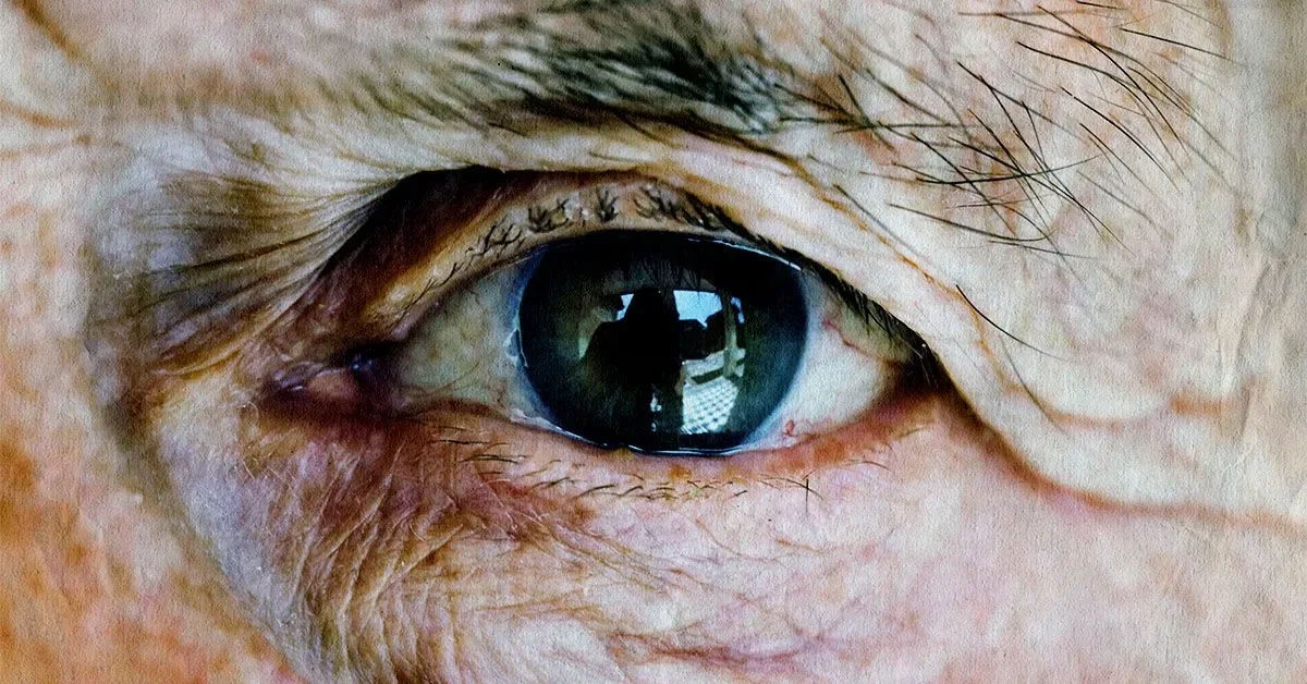 Glaucoma Treatment in Mumbai (Medical, Laser & Surgical)