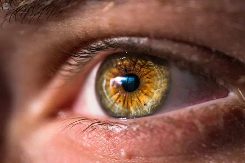 ICL Surgery in Mumbai (Phakic IOL for High Myopia)