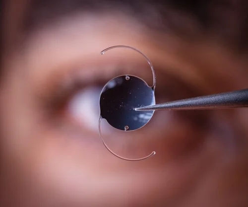 Multifocal IOL Surgery in Mumbai – Clear Vision at All Distances