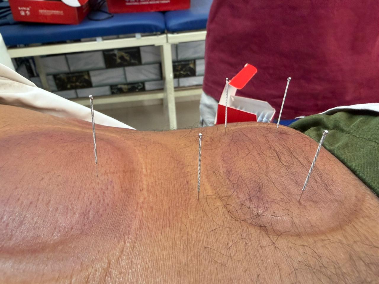 Physiotherapy Recovery
