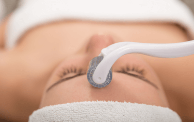 Microneedling Gesichtsbehandlung