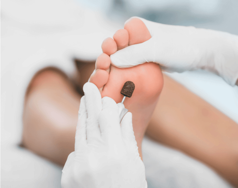 Medical foot treatment