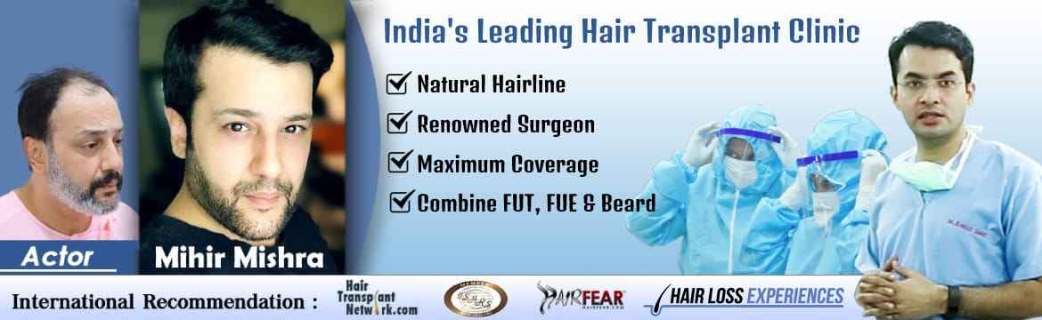 hair transplant in Jaipur