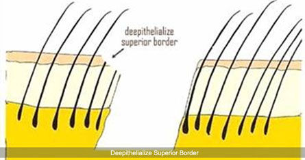 scarless appearance to strip method