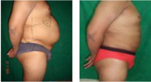 cosmetic surgery b