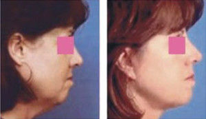 cosmetic surgery j