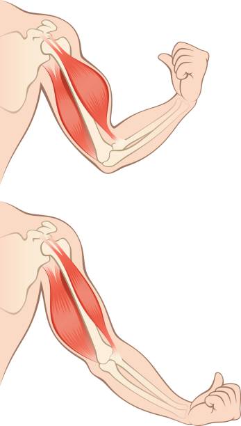 brachial-plexus-surgery