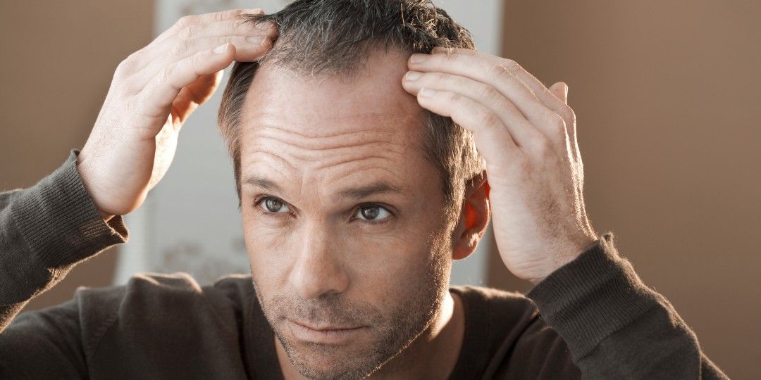 hair transplant in rajasthan