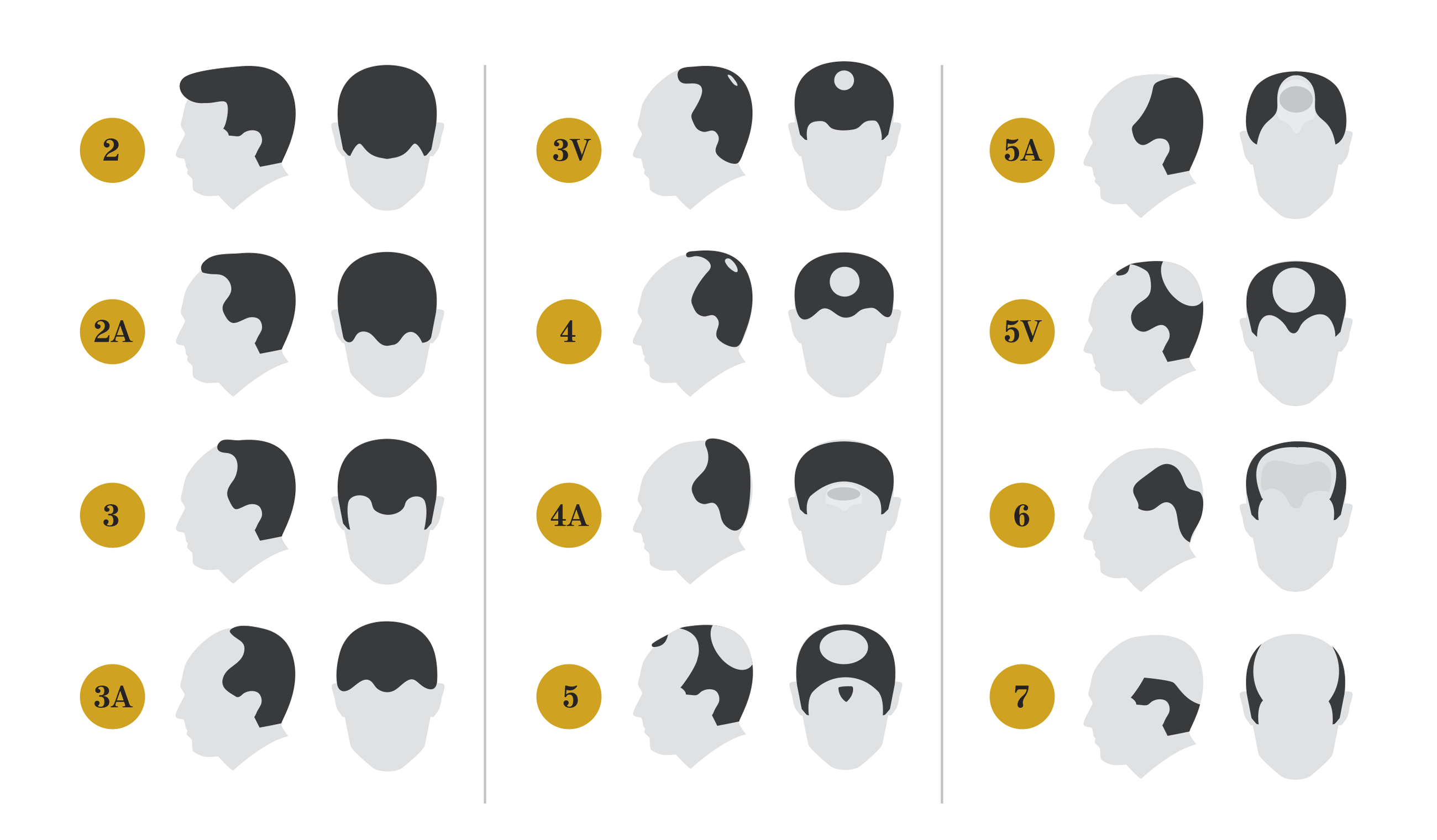 Norwood scale