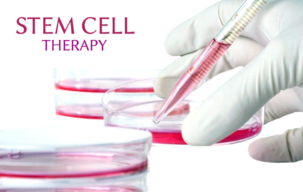 stem-cell-therapy