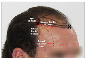 temporal triangle explanation